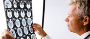 2nd.MD Blog, the latest news about the benefits of second opinions via online video chat.